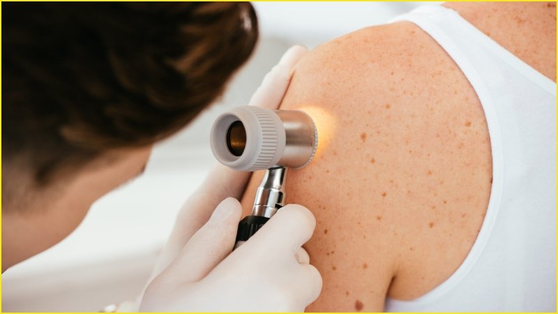 Skin Cancer Clinic